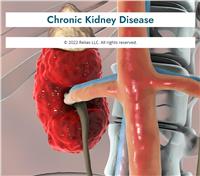 Chronic Kidney Disease