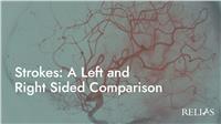 Strokes: A Left and Right Sided Comparison