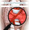 An Overview of Thyroid Disorders